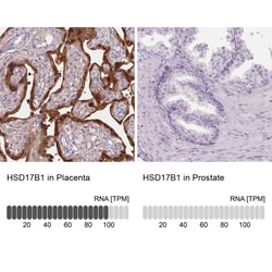 17 beta-HSD1/HSD17B1 Antibody, Novus Biologicals:Antibodies:Primary Antibodies